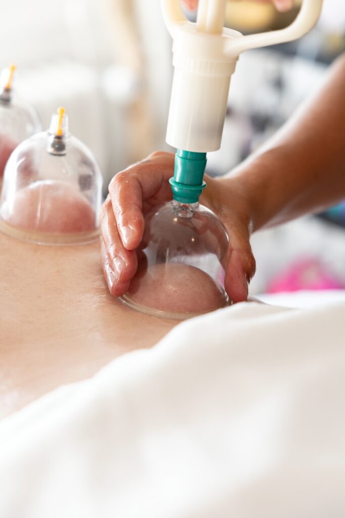 Cupping - Auralilja